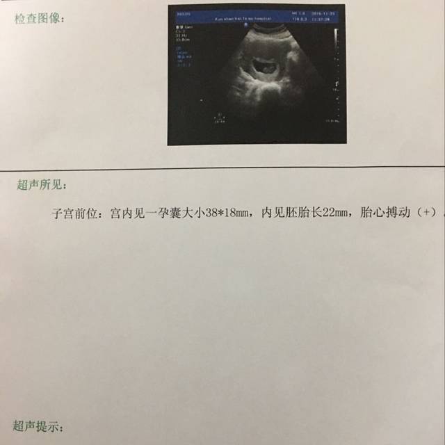 北京职业助孕地址，北京供卵中心地址（北京供卵平台）