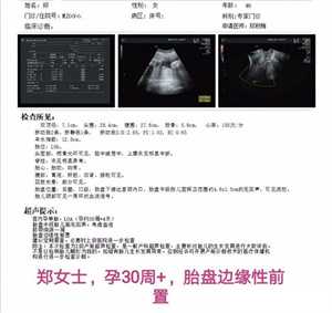 北京供卵咨询中心在哪,北京正规的供卵中心在哪？306医院有赠卵试管吗？