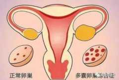 北京无卵巢借卵试管代生，北京做三代试管婴儿的医院