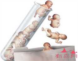 北京最便宜供卵试管公司，北京哪做试管婴儿好