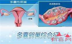 供卵北京代生孩子，北京做供精试管要花多少钱