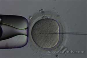 北京供卵助孕包成功率，北京公立供卵试管医院有哪些？